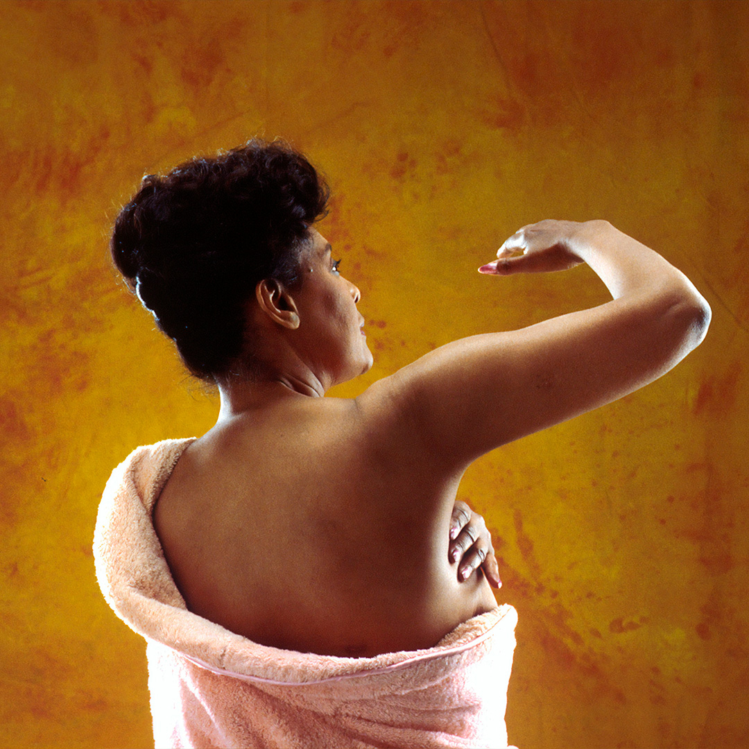 Lymphoedema: What is it and how do we treat it?